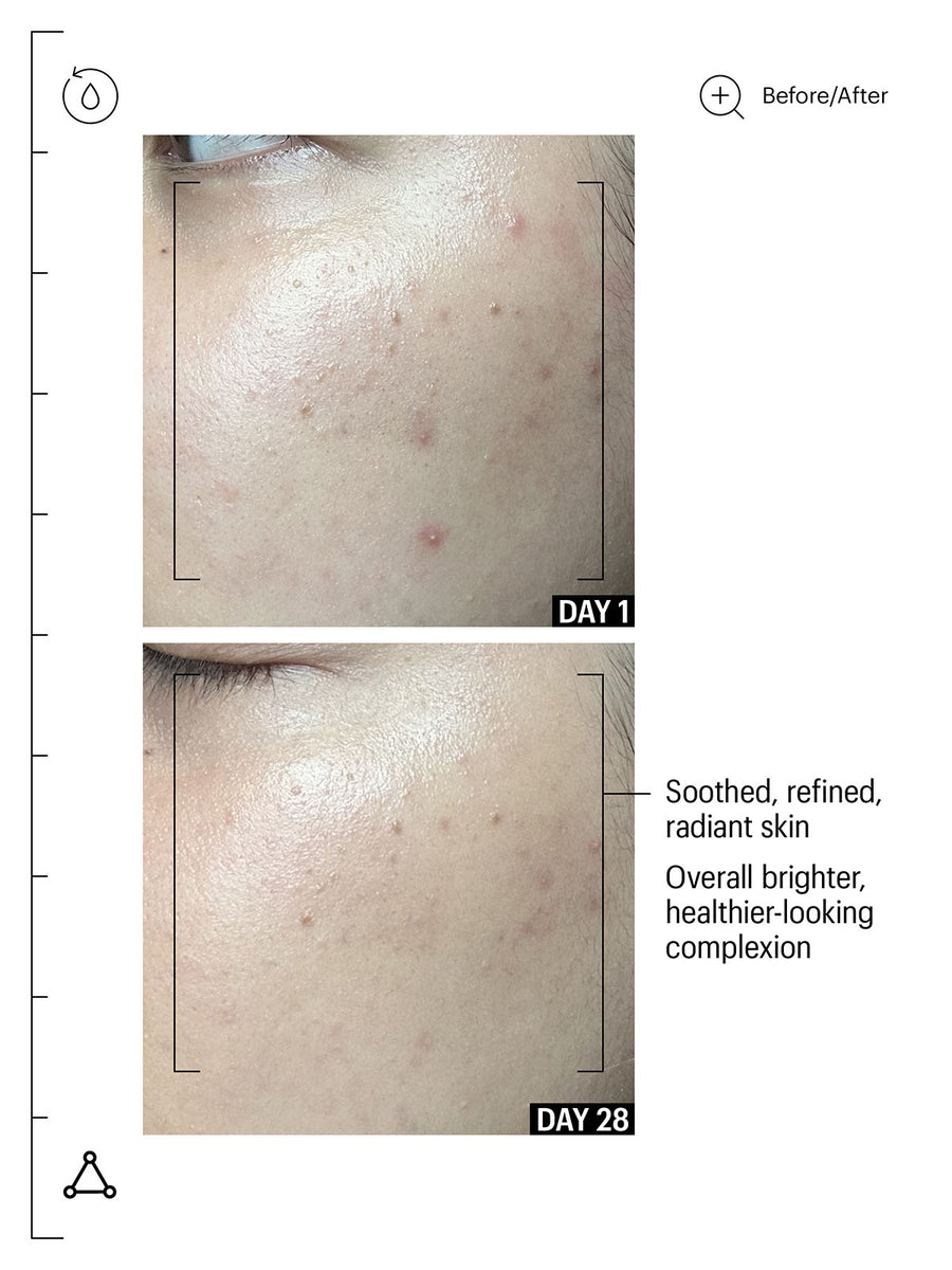 20% Vitamin C Brighten + Firm Serum