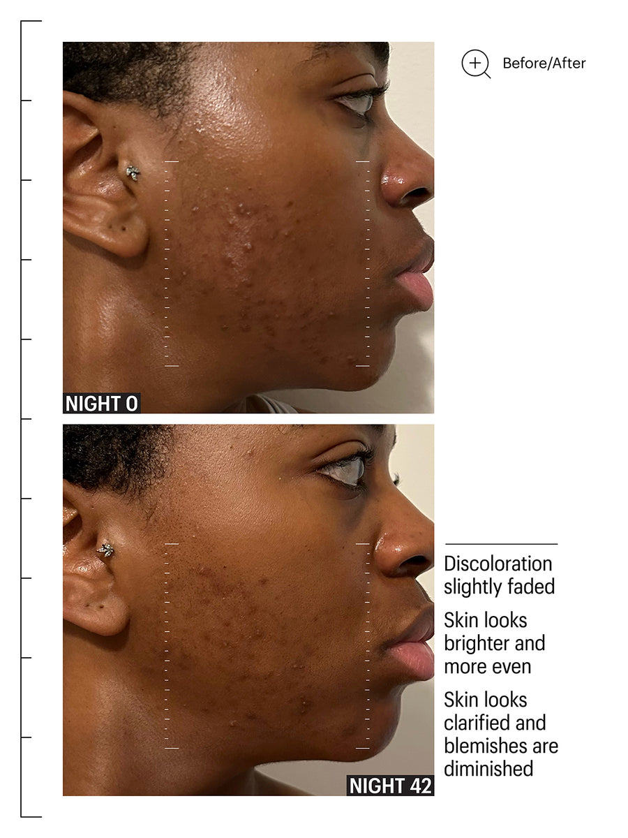 Mandelic Pigmentation Corrector Night Serum
