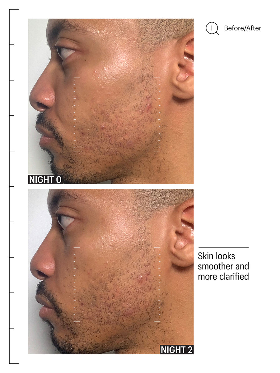 Multi Acids & Retinoid Brightening Sleeping Facial