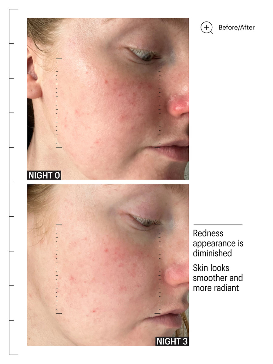 Multi Acids & Retinoid Brightening Sleeping Facial
