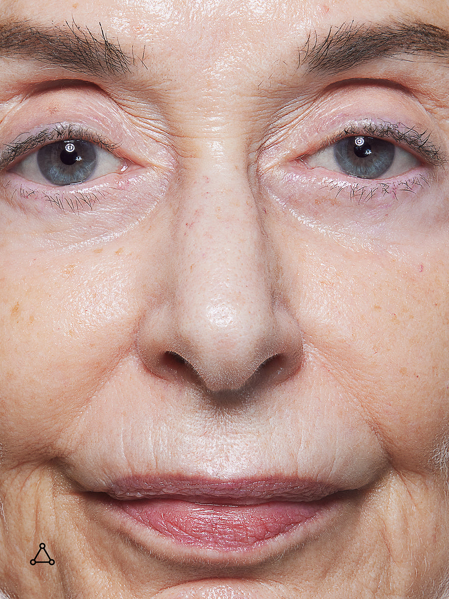 Multi Nutrient & Dioic Renewing Cream