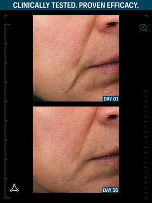 ULTIMATE LIFTING DUO