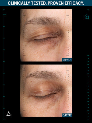 RENEW SKIN + LIPS DUO