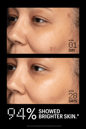 Azelaic & Kojic Advanced Clarifying Serum