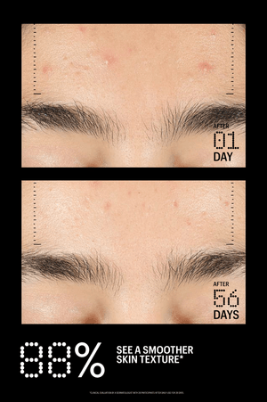 Azelaic & Kojic Advanced Clarifying Serum