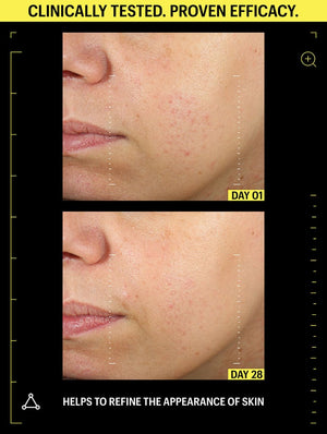 skin refinement night cream