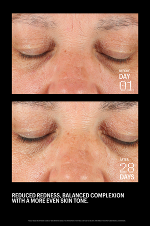 Copper Tripeptide & Ectoin Advanced Repair Serum 