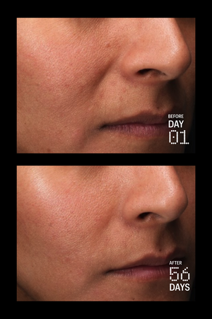 Multi Peptides & GF (Growth Factor) Advanced Lifting Serum