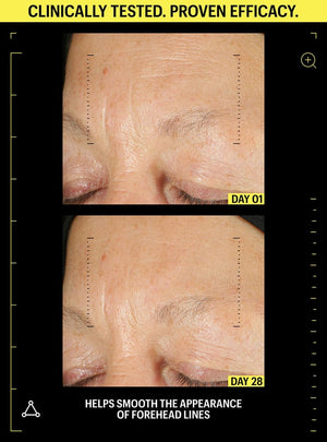 retinol before and after